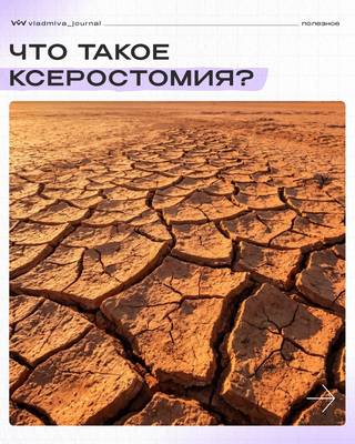 Ксеростомия: причины и современные методы лечения.